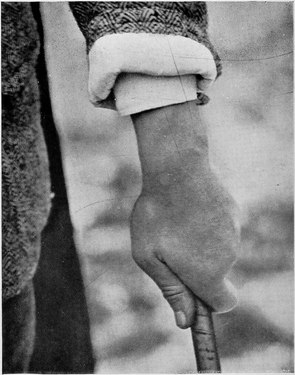 Harry Vardon's left hand alone on the club, thumb extended straight down the shaft